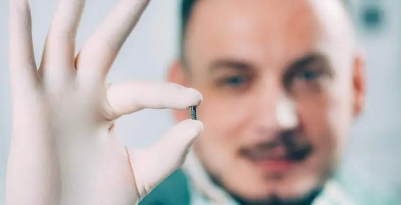 Comparing Dental Implant Costs: Turkey vs. Europe and the United States Comparing Dental Implant Costs: Turkey vs. Europe and the United States