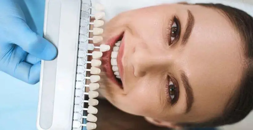 What are dental veneers teeth made of?