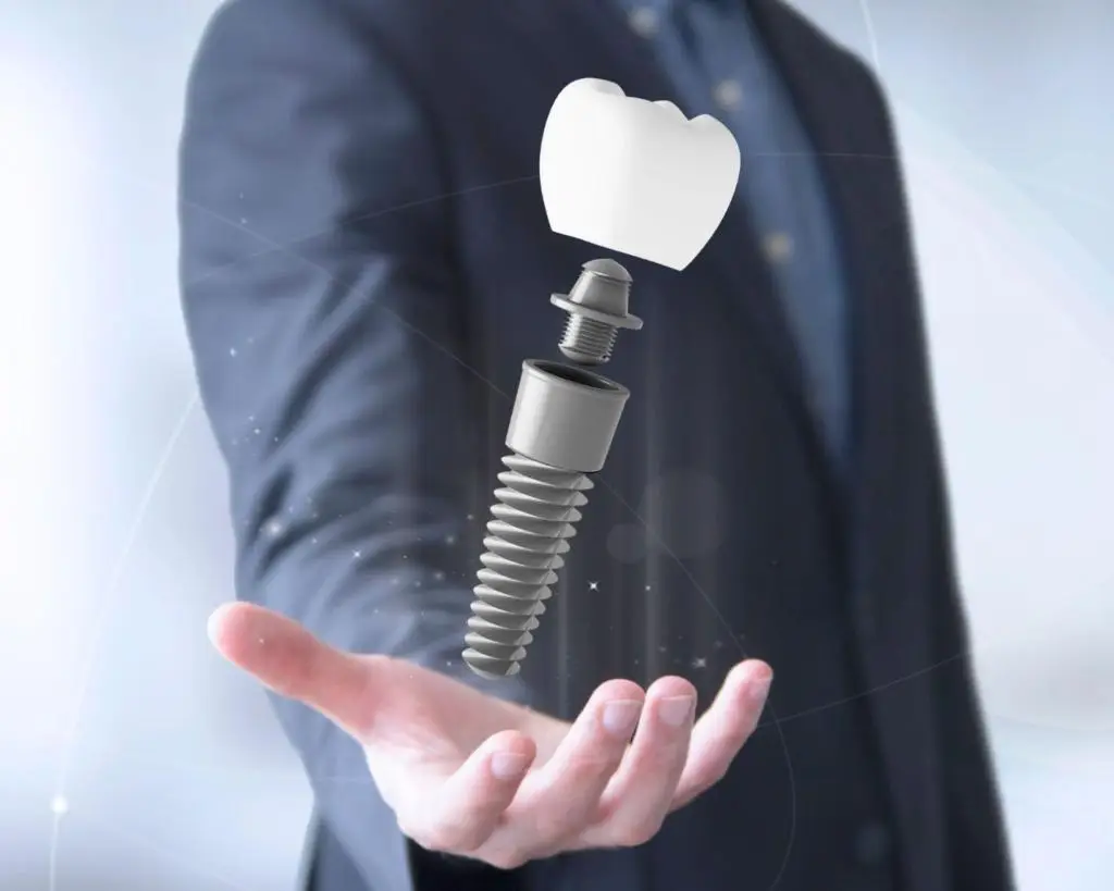 Guided dental implant treatment