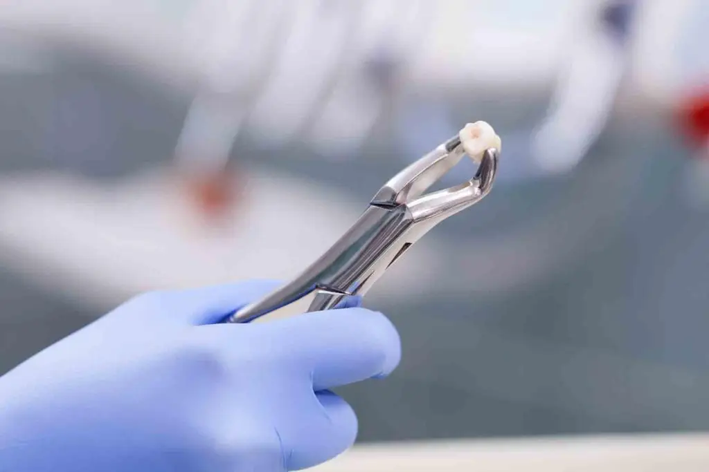 Tooth extraction treatment