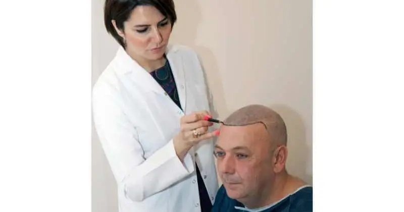 Hair Transplant in Turkey: A Leading Destination for Natural Hair Restoration