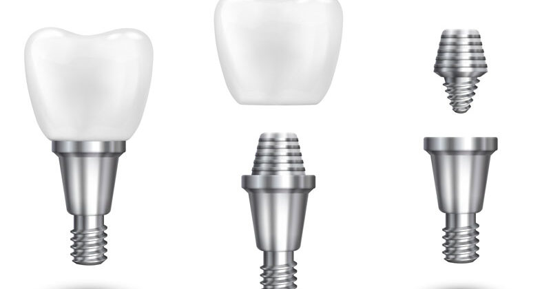 Transform Your Smile with Dental Implants in Marmaris, Turkey Transform Your Smile with Dental Implants in Marmaris, Turkey