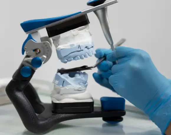 Why UK Patients Are Choosing Turkey for Full Mouth Dental Implants