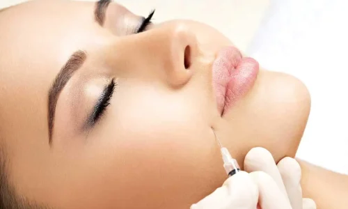 botox2